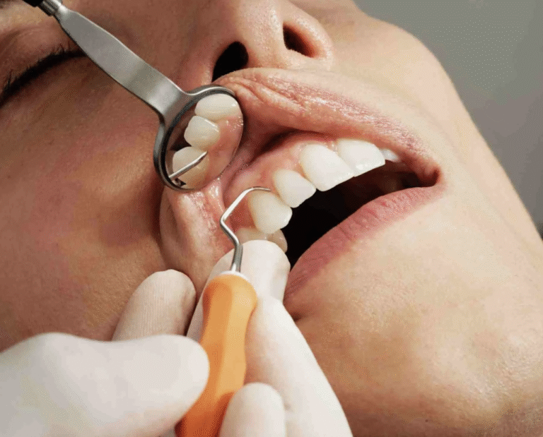 Dental hygienist performing professional teeth cleaning in Grayson